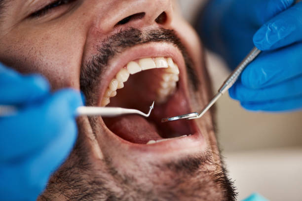 Best Broken Tooth Emergency  in Jeanerette, LA